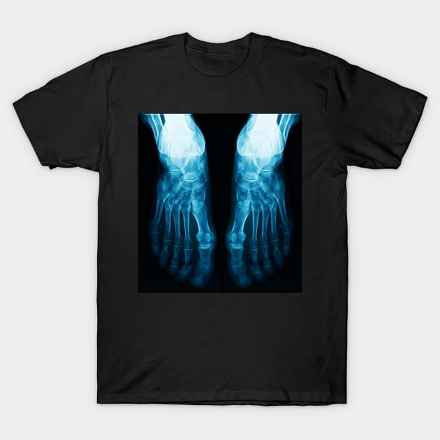 X-Ray Feet T-Shirt by mooonthemoon